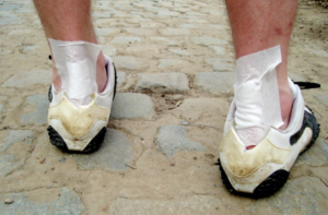 ankle injury