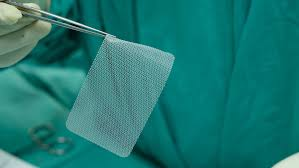 How to Choose a Good Hernia Surgery Doctor